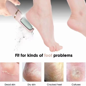 Lime Électrique Rechargeable pour Pieds – Soin Anti-Callosités avec Recharge USB Rapide